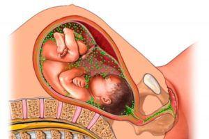 Хламидиоз при беременности: пути заражения, симптомы, лечение